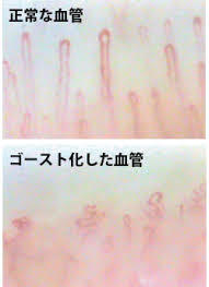 自分の毛細血管を観てみよう。